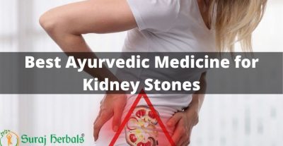 2 Best Ayurvedic Medicines For Kidney Stones {2022 Update}