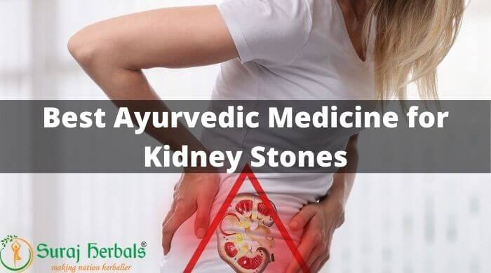 Best Ayurvedic Medicines For Kidney Stones
