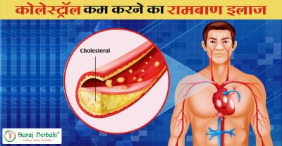 कोलेस्ट्रॉल (Cholesterol) कम करने का रामबाण इलाज